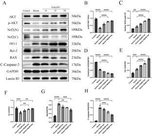 Kaempferol Plays a Neuroprotection Role by Alleviating Oxidative Stress via AKT/Nrf2/HO-1 Pathway and Inhibiting Apoptosis in Intracerebral Hemorrhage