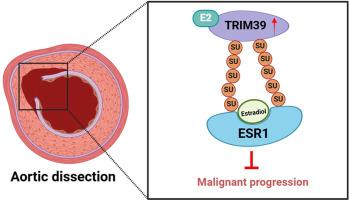 TRIM39 reinforces E2-ESR1 signaling through SUMOylation of ESR1 to hinder the progression of aortic dissection