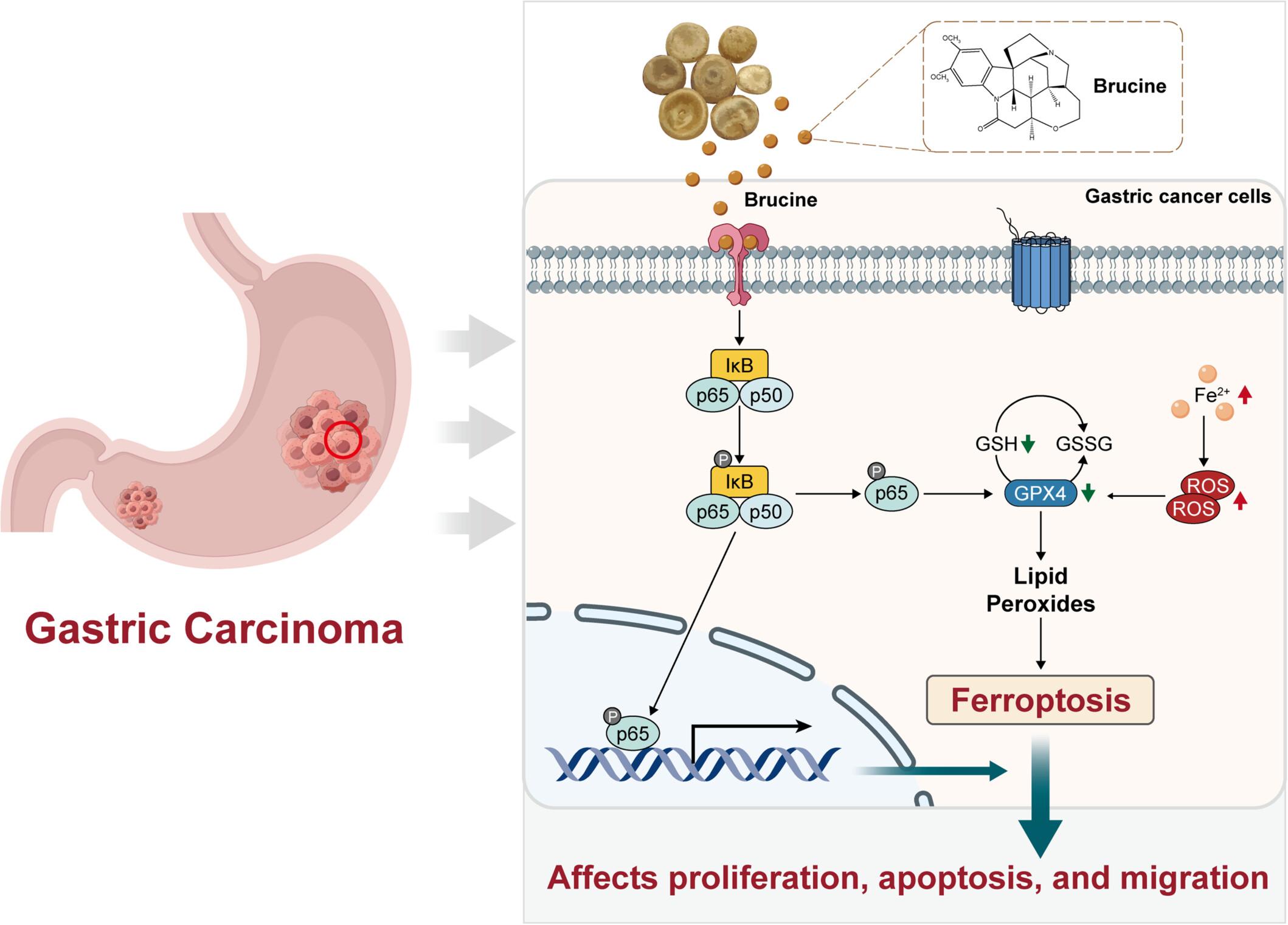 Brucine Inhibits Gastric Cancer via Activation of Ferroptosis Through Regulating the NF-κB Signaling Pathway