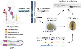 Rbm8a deficiency causes hematopoietic defects by modulating Wnt/PCP signaling