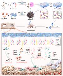 An injectable phosphocreatine-grafted hydrogel incorporating hierarchically structured teriparatide/SrZnP-functionalized Zn–Cu particles for osteogenesis–angiogenesis coupling and osteoporotic bone regeneration