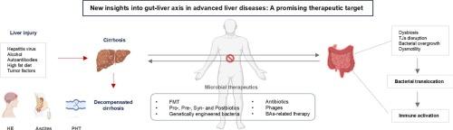 New insights into gut-liver axis in advanced liver diseases: A promising therapeutic target