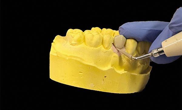 Effectiveness of PEEK ultrasonic tips and cement types on residual cement around implant-supported restorations