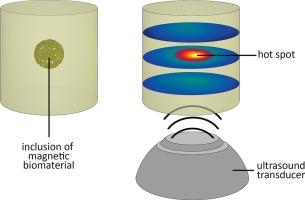 Controlled localization of ultrasound heating using magnetic nanoparticle assemblies