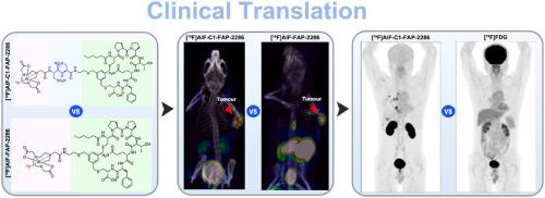 Development of novel 18F-labelled FAP-targeting tracers with improved pharmacokinetics: From preclinical optimization to clinical translation