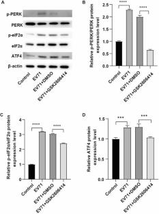 Inhibition of PERK-eIF2α-ATF4 signaling enhances the antiviral effects of resveratrol-loaded nanoparticles against enterovirus 71 in hand, foot, and mouth disease