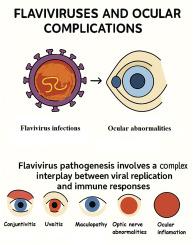 The ocular immune system and Flaviviruses: A crossroad between defense and disease