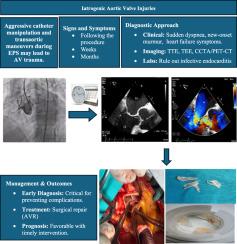 Iatrogenic Aortic Valve Injury: Case Series and Review of the Literature