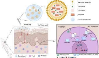 Film-forming system of optimized tacrolimus-loaded nanostructured lipid carriers for effective topical treatment of atopic dermatitis