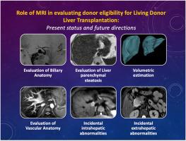 Role of Magnetic Resonance Imaging in Evaluating Donor Eligibility for Living Donor Liver Transplantation: Present Status and Future Directions