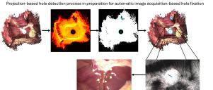 3D-Scan hole detection for robot-assisted laparoscopic surgery