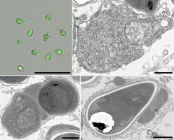 Morphological and molecular characterization of a new species, Cyclopispora nantong n. gen. n. sp. from the adipose tissue of Eucyclops speratus (Crustacea: Cyclopidae)