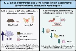 IL-33 links inflammation and bone remodeling in experimental spondyloarthritis and human joint biopsies