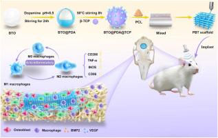 Ultrasound-activated piezoelectric scaffolds target dual Ca2+/NF-κB signaling pathways to orchestrate immunomodulation and osteogenesis for accelerated bone regeneration