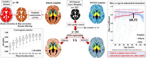 Developing and validating an elderly brain template: A comprehensive comparison with MNI152 for age-specific neuroimaging analyses