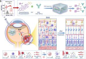 Alkaline phosphatase-responsive hydrogel for efficient management of autoimmune intraocular inflammation