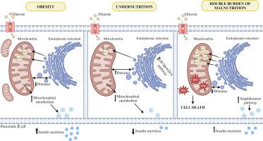 Disruption of mitochondria-associated membranes contributes to the dysregulation of insulin secretion in undernutrition, obesity, and double burden of malnutrition