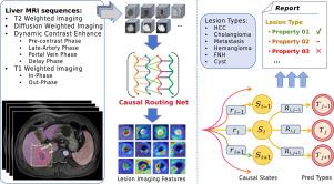 Correlation Routing Network for Explainable Lesion Classification in Multi-Parametric Liver MRI