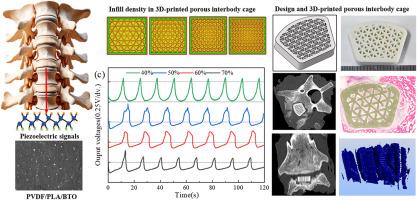 Innovative 3D-printed porous piezoelectric poly(vinylidene fluoride) cages with accelerated spinal fusion