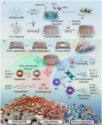 3D-printed functionalized strontium-silk fibroin-hydroxyapatite scaffolds facilitate bone regeneration via immunomodulatory and sequential angiogenic-osteogenic coupling