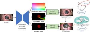 Real-time tracking and inpainting network with joint learning iterative modules for AR-based DALK surgical navigation
