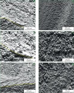 Development and Research of Cermets Based on the NiAl–Al2O3 System Modified with MgAl2O4 Nanoparticles and Y2O3 Microparticles