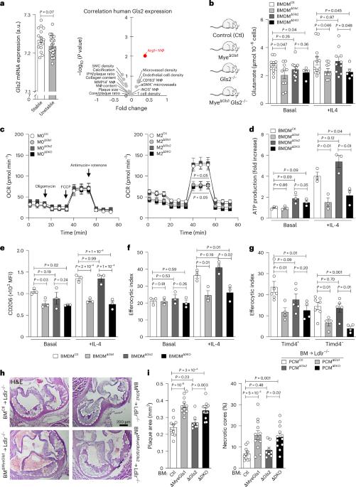 Slc7a7 licenses macrophage glutaminolysis for restorative functions in atherosclerosis