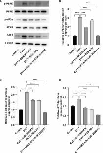 Inhibition of PERK-eIF2α-ATF4 signaling enhances the antiviral effects of resveratrol-loaded nanoparticles against enterovirus 71 in hand, foot, and mouth disease