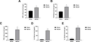 Key copper homeostasis genes and inflammatory mechanisms in ischemic stroke: A bioinformatics and experimental study
