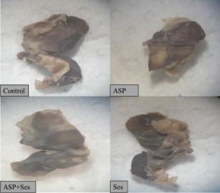 Sesame oil ameliorates aspartame-induced immunotoxicity in mice: a hematological, antioxidative, and histopathological evaluation
