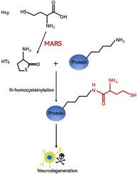 Inhibiting MARS attenuates hyperhomocysteinemia-associated neurodegeneration in Parkinson's disease