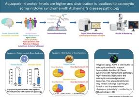 Regional differences in astrocytic Aquaporin-4 protein levels and distribution in aging and Alzheimer's disease in down syndrome