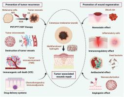 Multifunctional hydrogels for synergistic therapy of cutaneous melanoma-associated tumor recurrence and wound regeneration