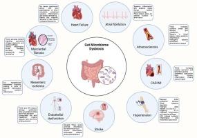 The gut microbiota and cardiovascular disease: Exploring the role of microbial dysbiosis and metabolites in pathogenesis and therapeutics