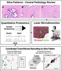 Silva pattern-guided proteomics reveals coordinated tumor-stroma remodeling in cervical adenocarcinoma