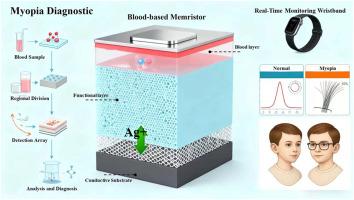 An innovative diagnostic method for myopia using blood-based biomemristor