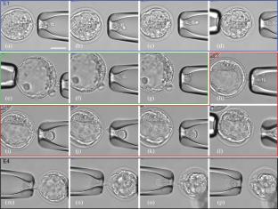 Embryo Trophectoderm Cell Biopsy Using Femtosecond Laser Pulses