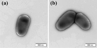 Hymenobacter cheonanensis sp. nov., and Hymenobacter convexus sp. nov. isolated from the construction site
