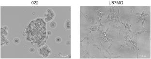 Development of an Experimental Intracranial PDX Model of Human Glioblastoma in NSG Mice