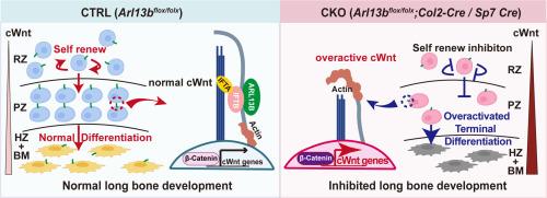 Primary cilia in growth plates orchestrate long bone development