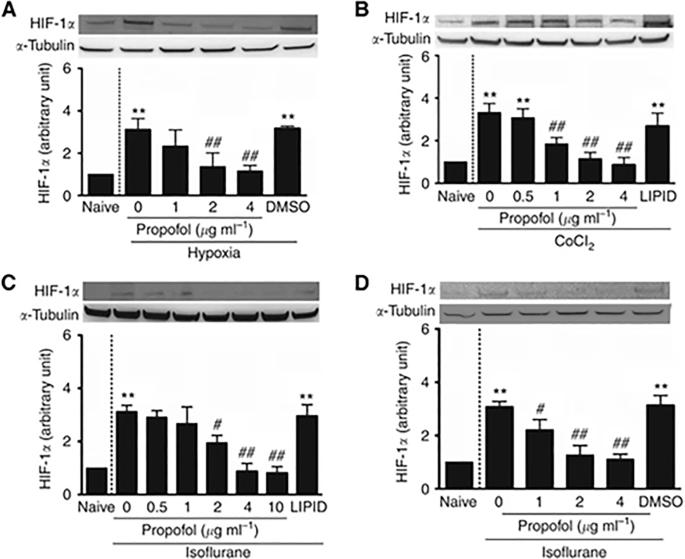 Correction to: Prostate cancer cell malignancy via modulation of HIF-1α pathway with isoflurane and propofol alone and in combination