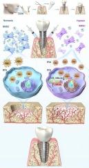Extracellular vesicles from hypoxia preconditioned bone marrow mesenchymal stem cell improve peri-implant osteogenesis under type 2 diabetes condition
