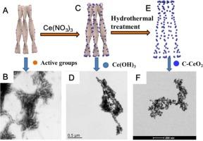 Facile synthesis of chiral C-doped cerium oxide nanoparticle assemblies in the presence of phenylalanine-derived surfactant and their non-enzymatic electrocatalysis of glucose
