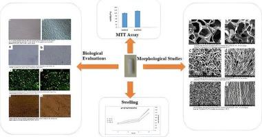 Fabrication of polyvinyl alcohol/gelatin/laminin scaffold for neural tissue engineering