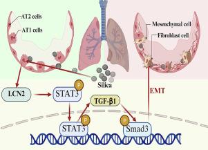 LCN2-positive alveolar type II cells promote silica-induced pulmonary fibrosis via STAT3-TGF-β1-Smad3-mediated signaling