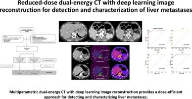 Reduced-dose dual-energy CT with deep learning image reconstruction for detection and characterization of liver metastases
