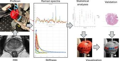 Spectral and stiffness characterization of whole prostate gland to assist superficial cancer detection during radical prostatectomy