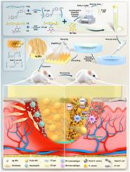 Dual ROS/pH-responsive mangiferin-loaded smart microneedles for precision therapy of wound infections