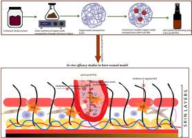 Biosynthesized lincomycin loaded copper oxide nanoparticles using cichorium intybus based thin film spray for enhanced antibacterial and wound healing