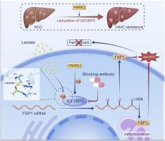 PARK7-driven IGF2BP3–K76 lactylation mediates ferroptosis and HAIC resistance in hepatocellular carcinoma